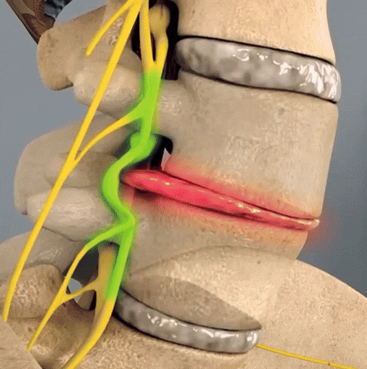 The Athlete’s Secret: LED Light Therapy Belt for Sports Injuries and Fast Recovery