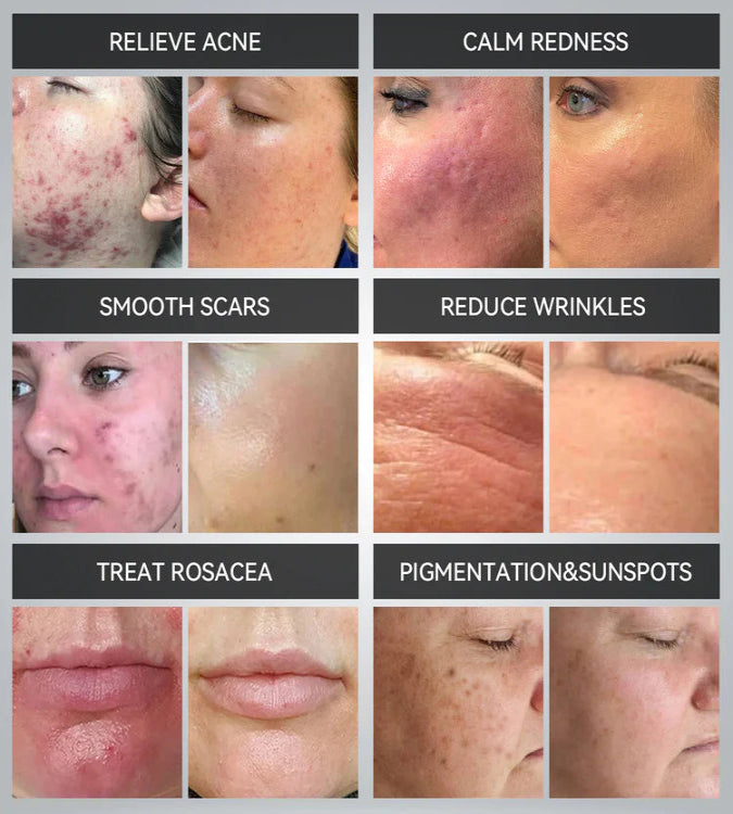 7 Color Infrared PDT LED Therapy Skin Care Device-LUMILUX